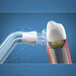 Waterpik WPS-2E końcówki do pielęgnacji implantów, mostów do IRYGATORA WF-05,06 - 2 szuki